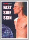 East Side Skin